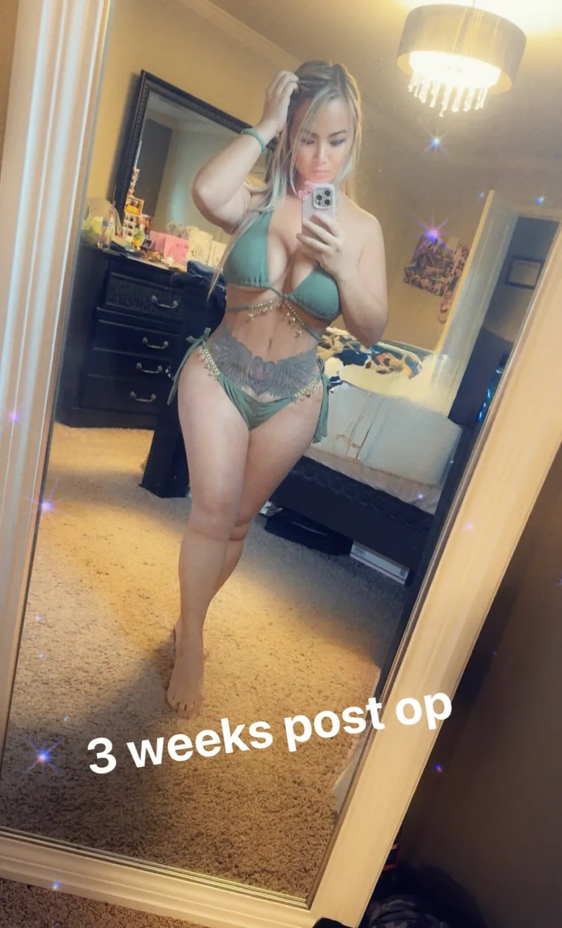 Client photo labeled 3 weeks post op
