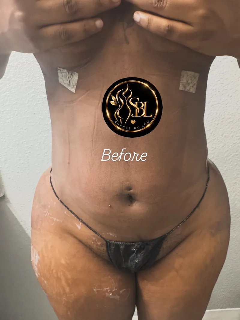 Client photo labeled before