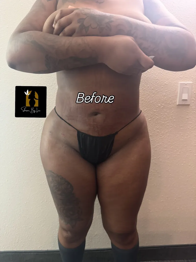 Client front photo labeled before
