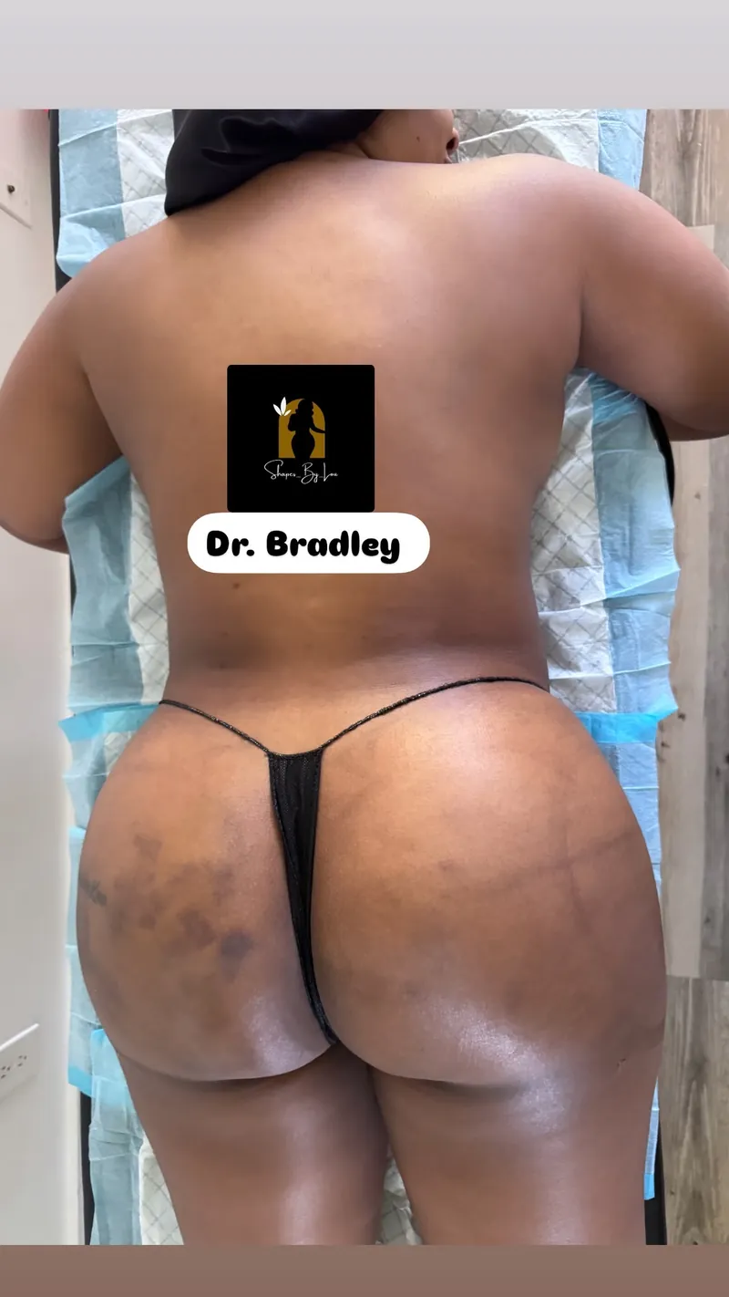 Client recovery photo